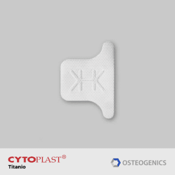Cytoplast-Ti150-Posterior singles T2