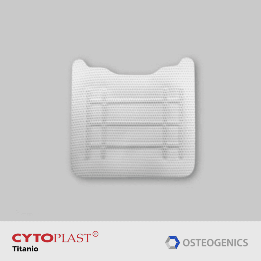 cytoplast-Ti150-posterior-distal