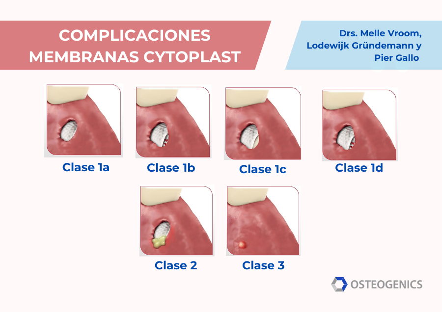 complicaciones membranas cytoplast